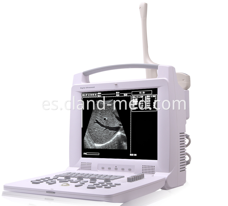 Pl 3018i Full Digital Portable Ultrasound Scanner 18